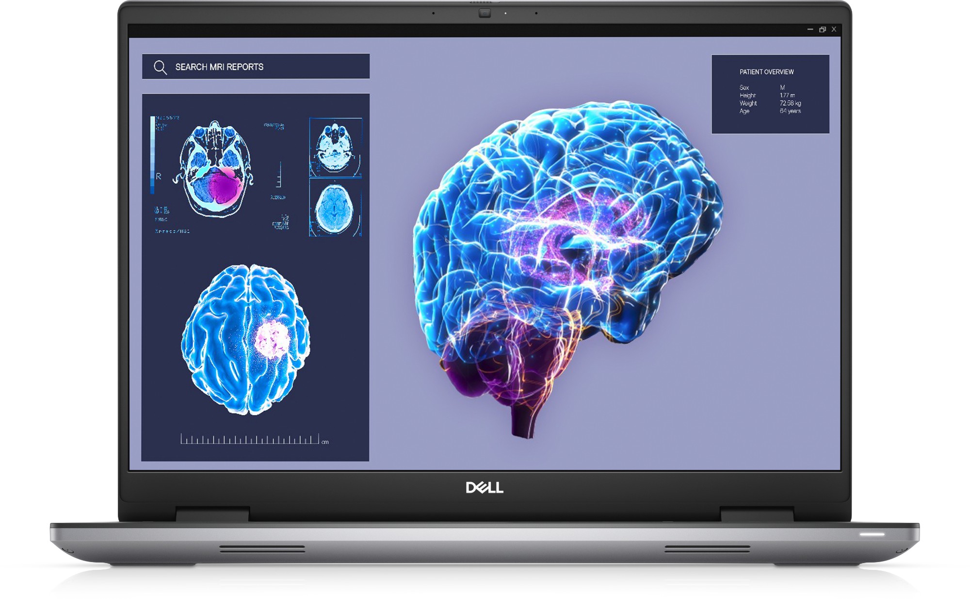 CM2DV - DELL